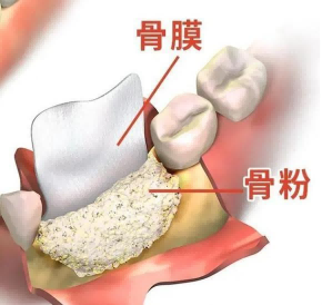骨粉类